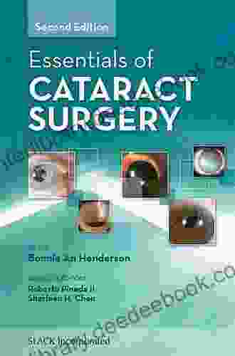 Essentials Of Cataract Surgery Second Edition